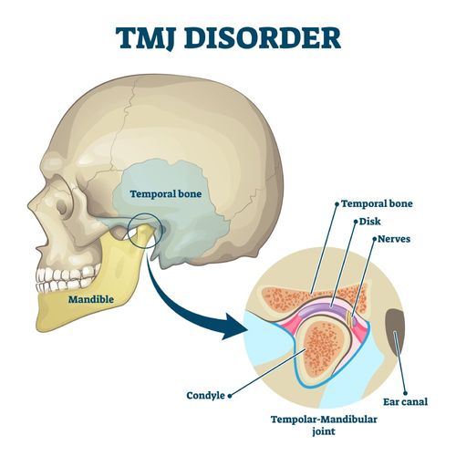 TMJ & TMD